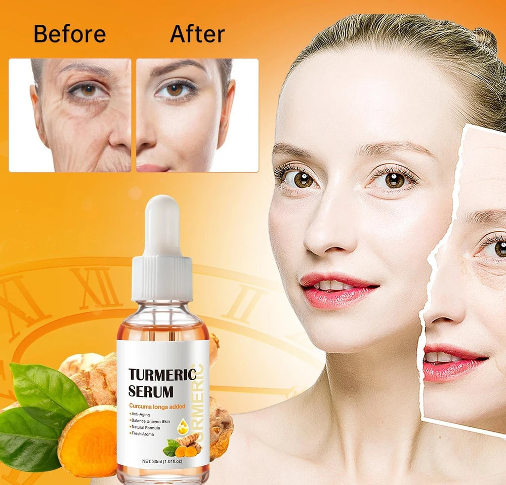 Turmeric Dark Spot Serum